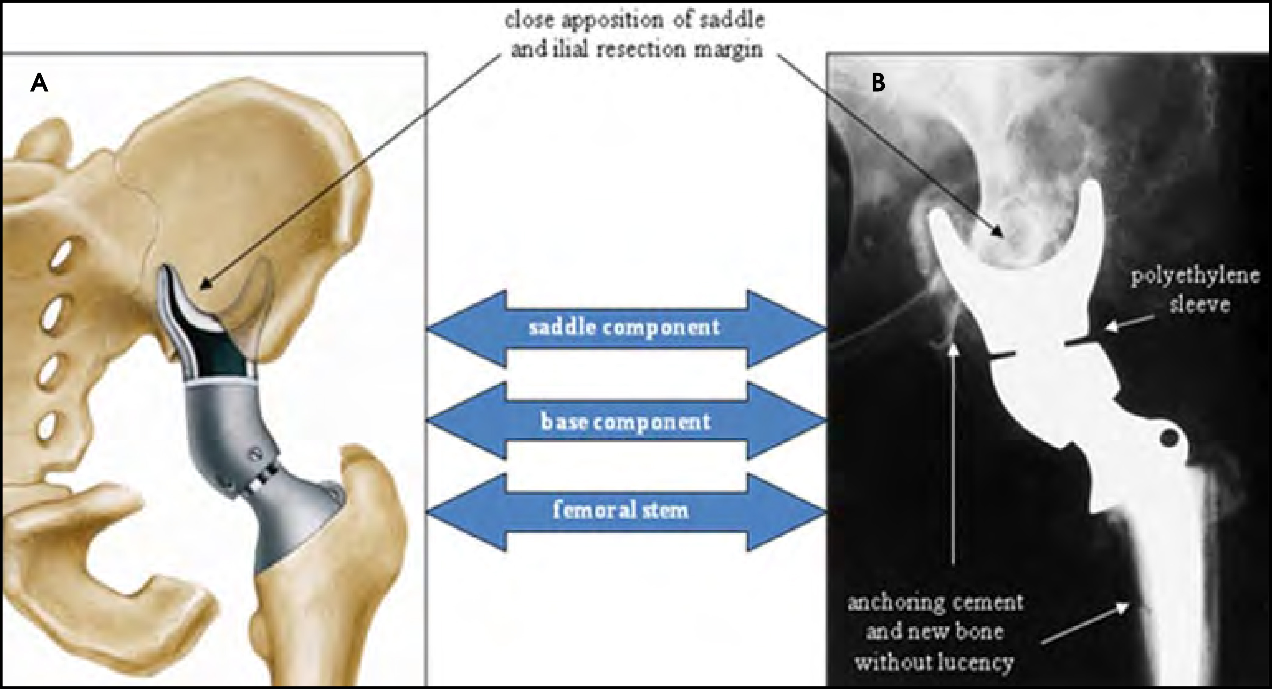FIGURE 11.