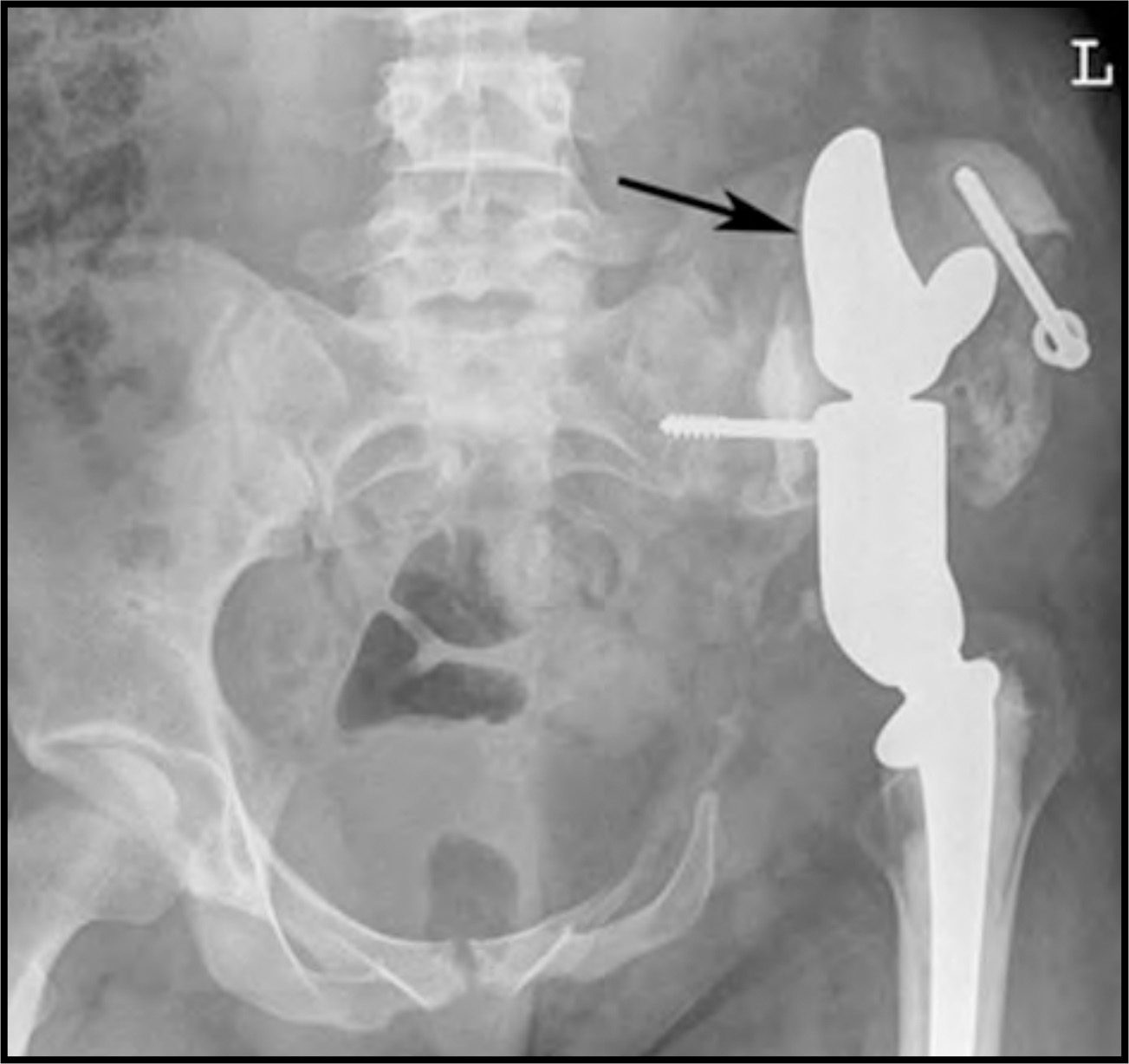 FIGURE 13.