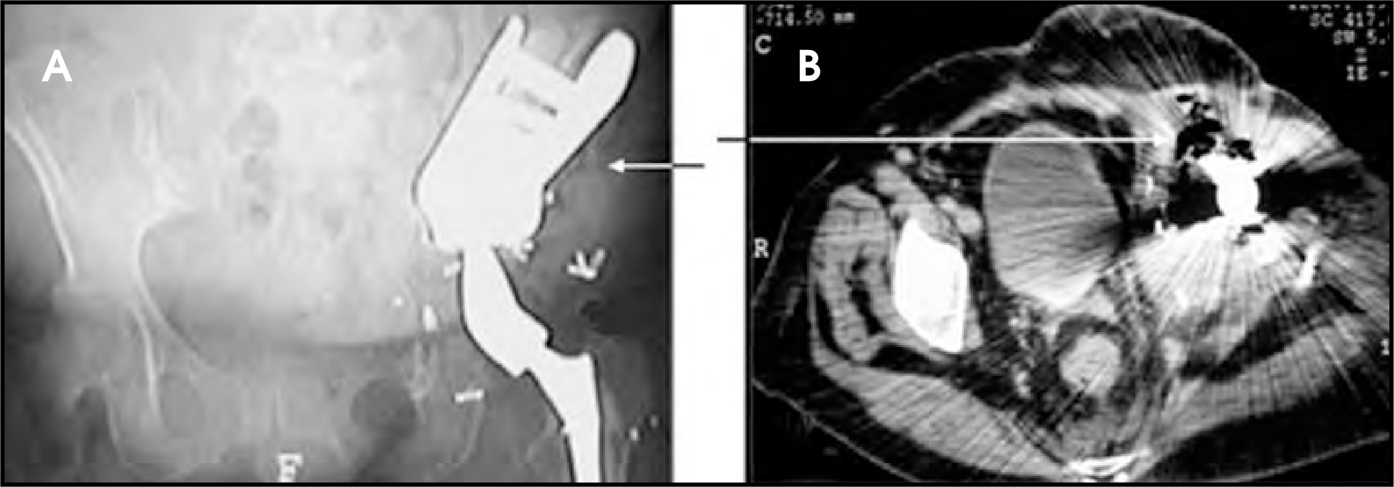 FIGURE 14.