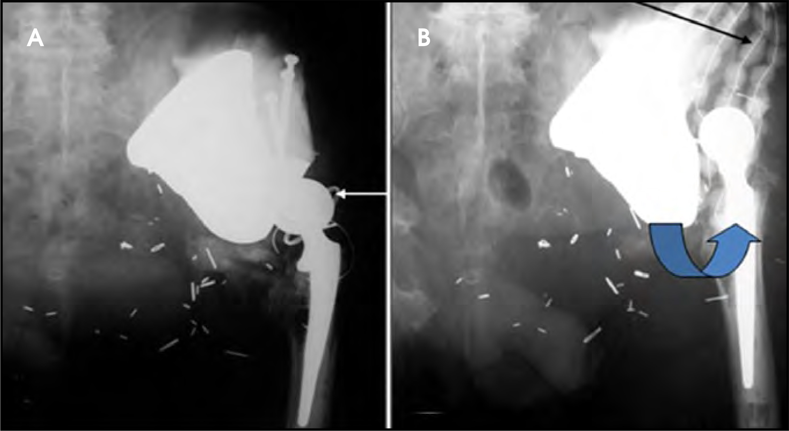 FIGURE 16.