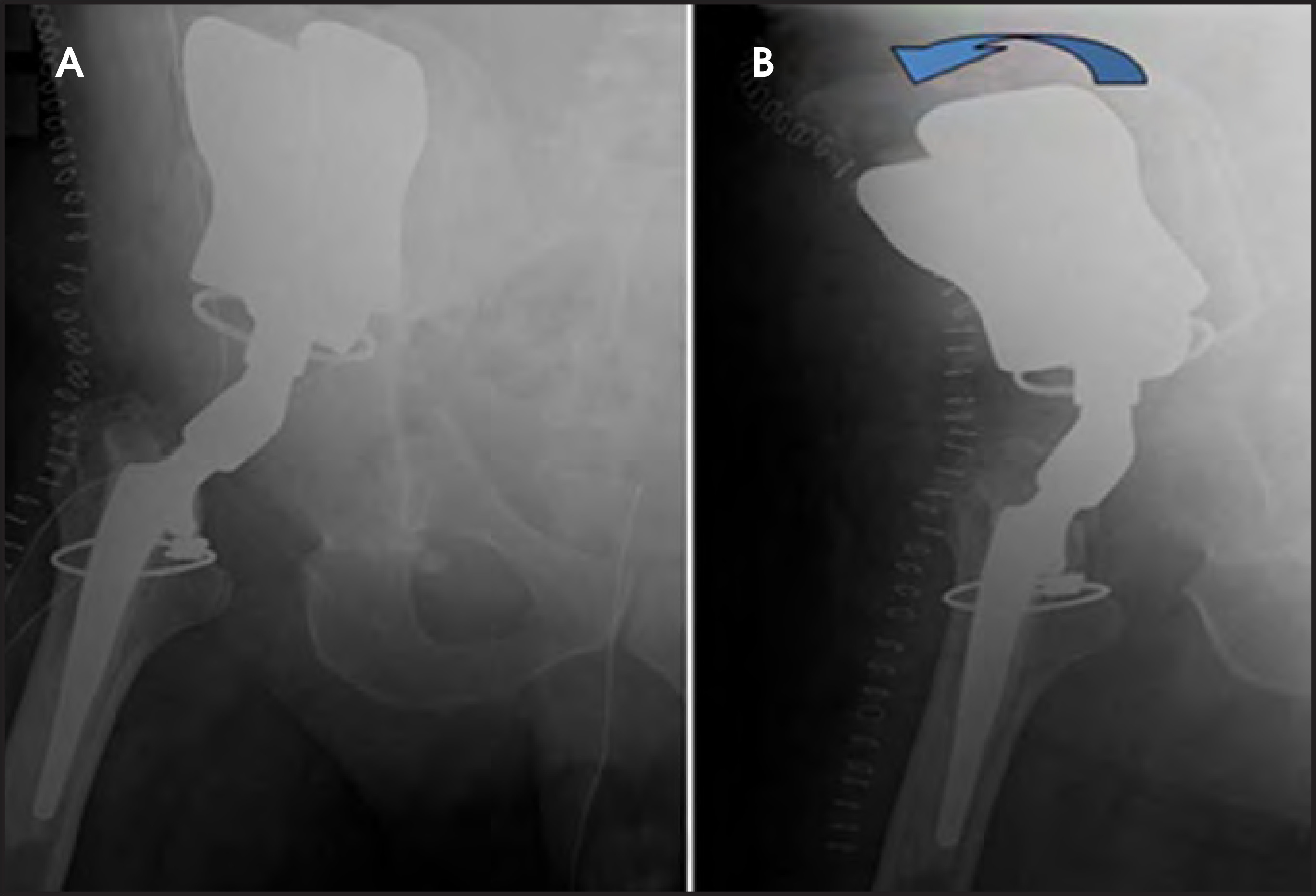 FIGURE 17.