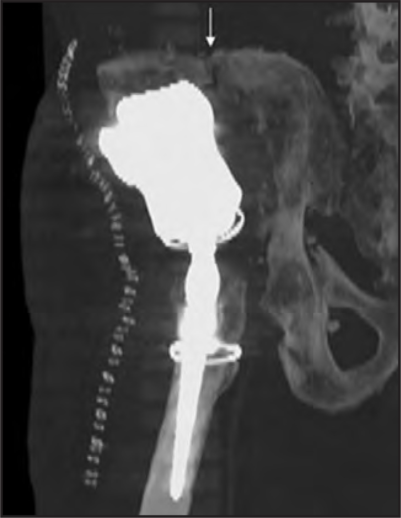 FIGURE 18.