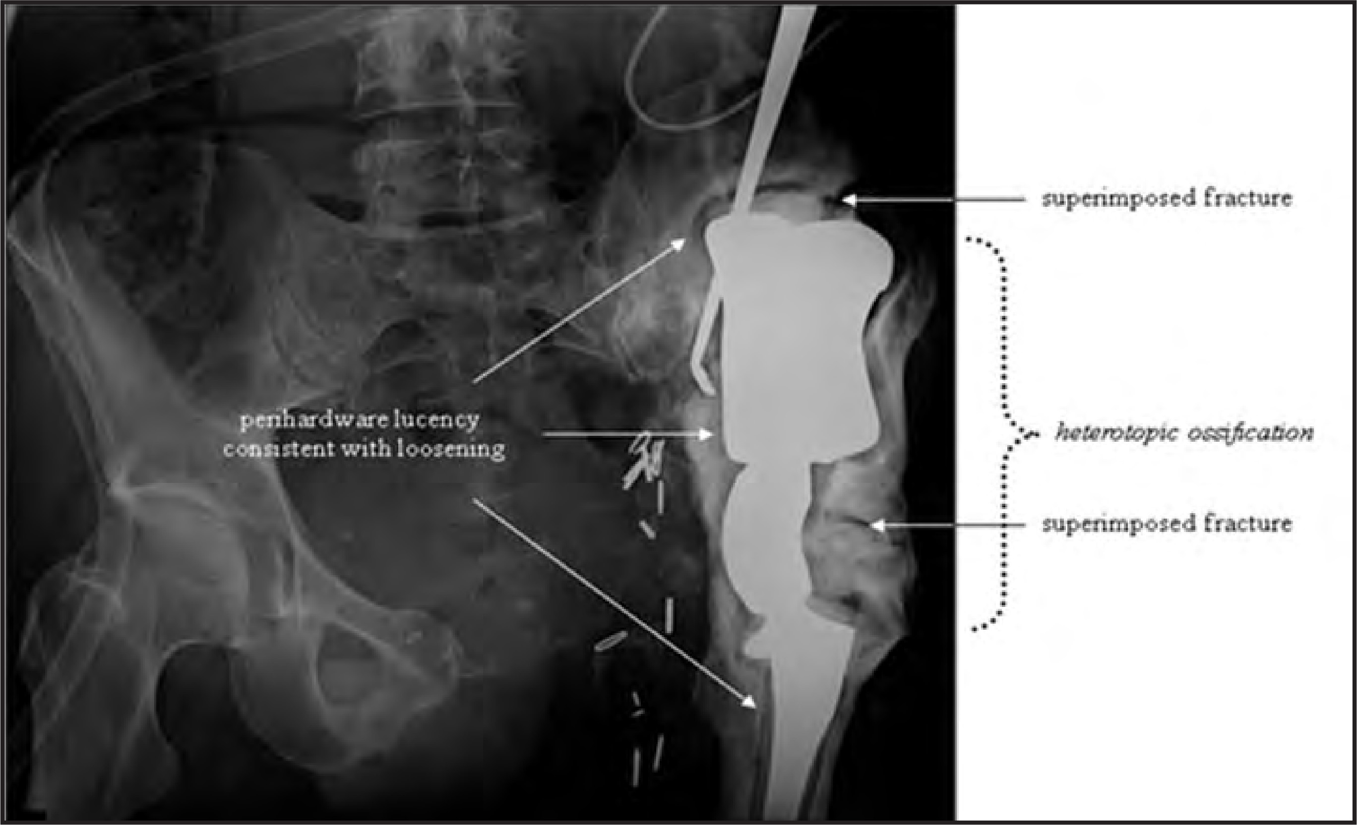 FIGURE 19.
