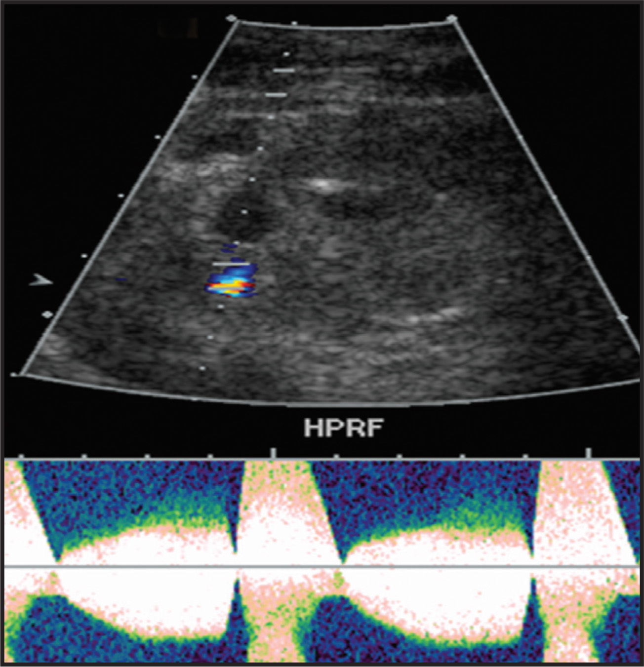 FIGURE 13.