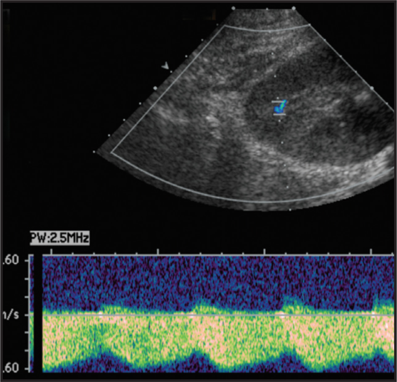 FIGURE 14.