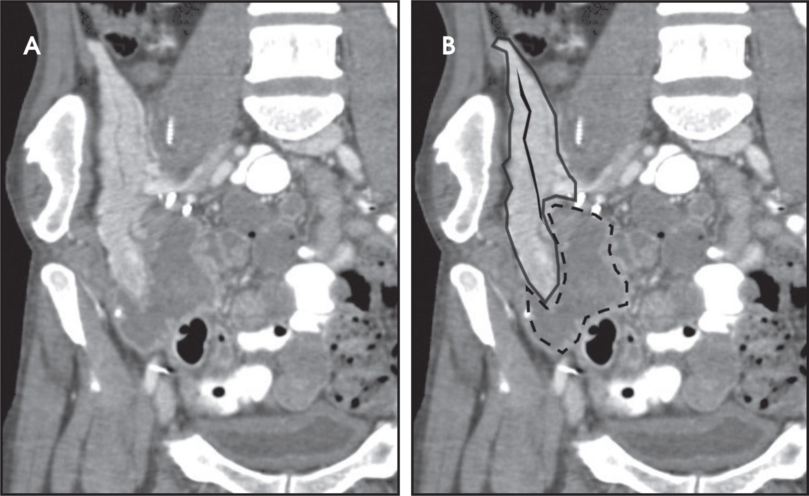 FIGURE 17.