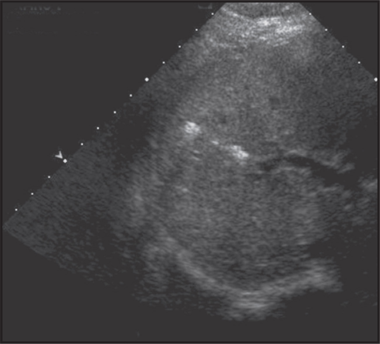 FIGURE 21.