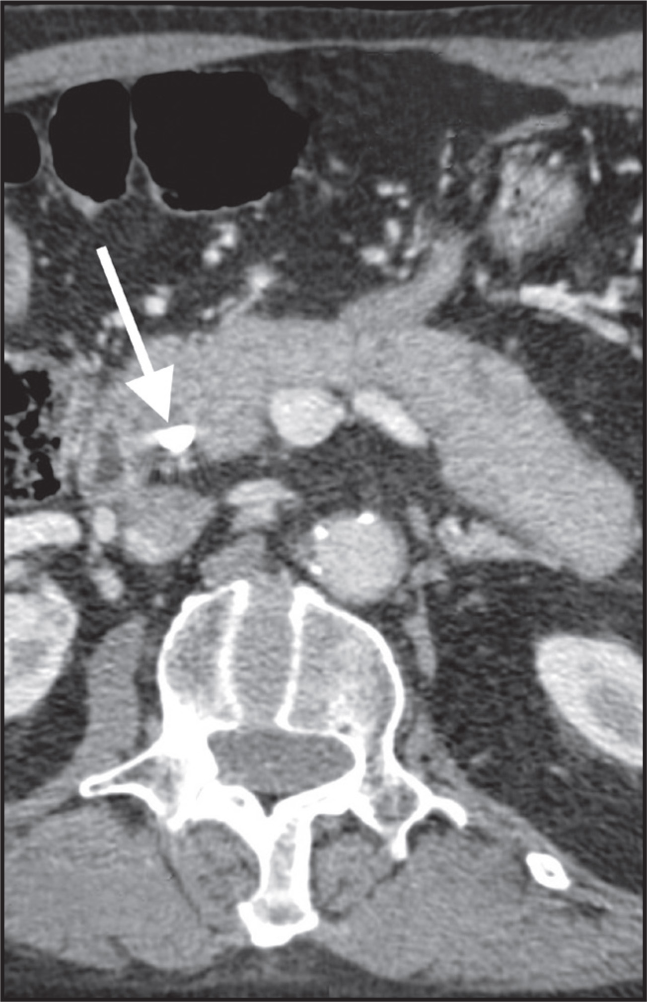 FIGURE 11.