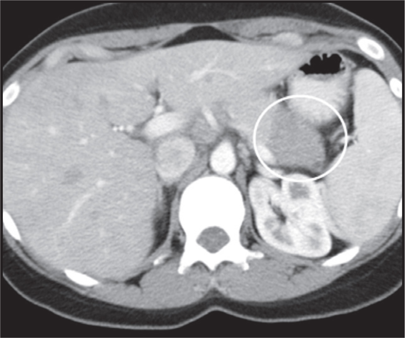 FIGURE 12.