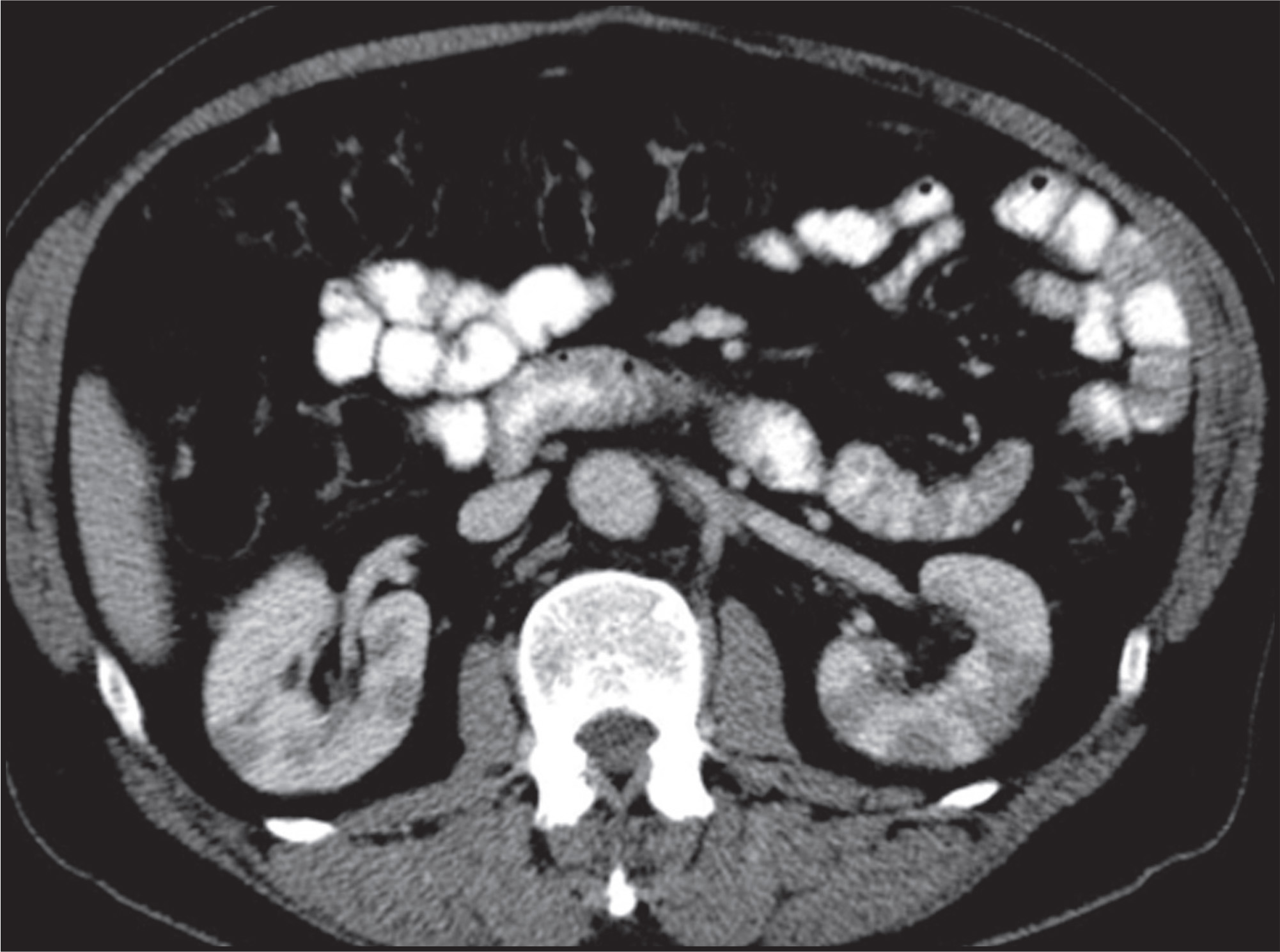 FIGURE 14.