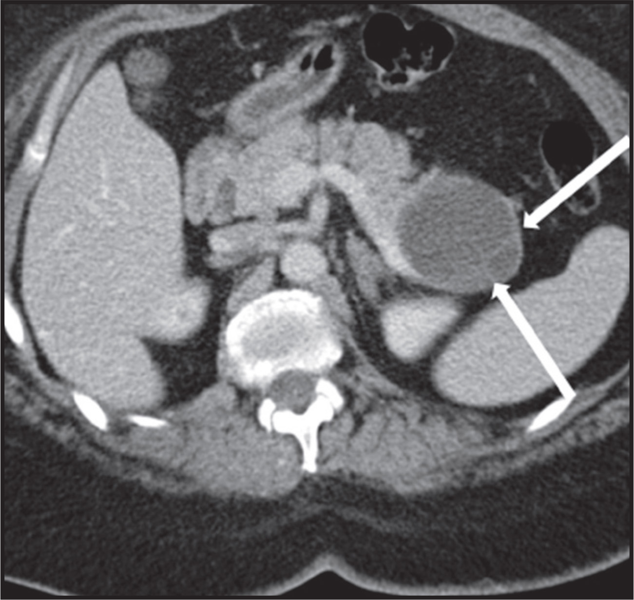 FIGURE 15.