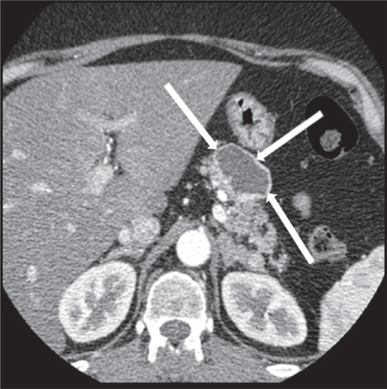 FIGURE 17.