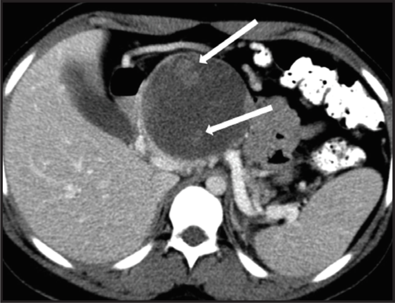 FIGURE 18.