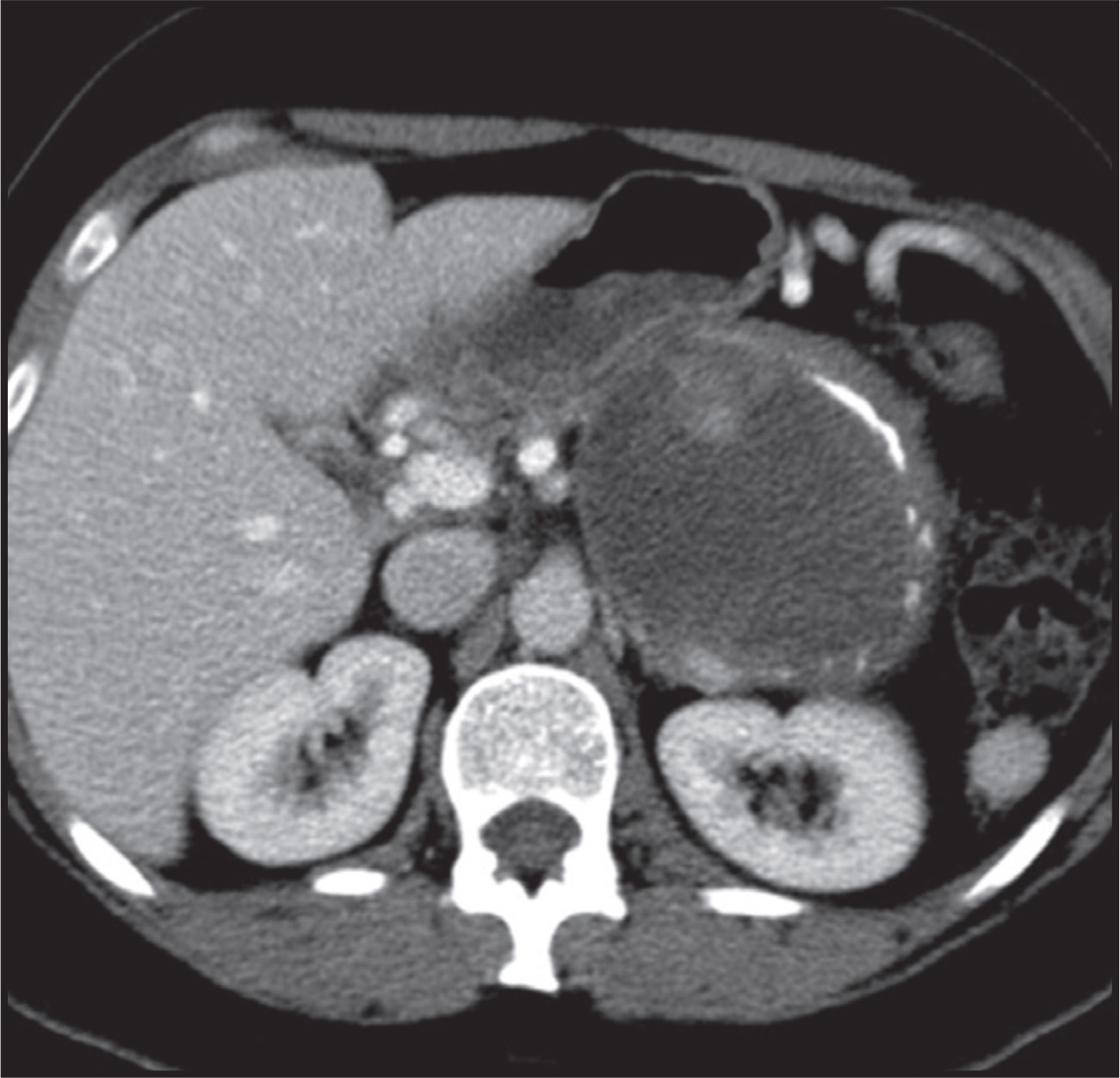FIGURE 19.