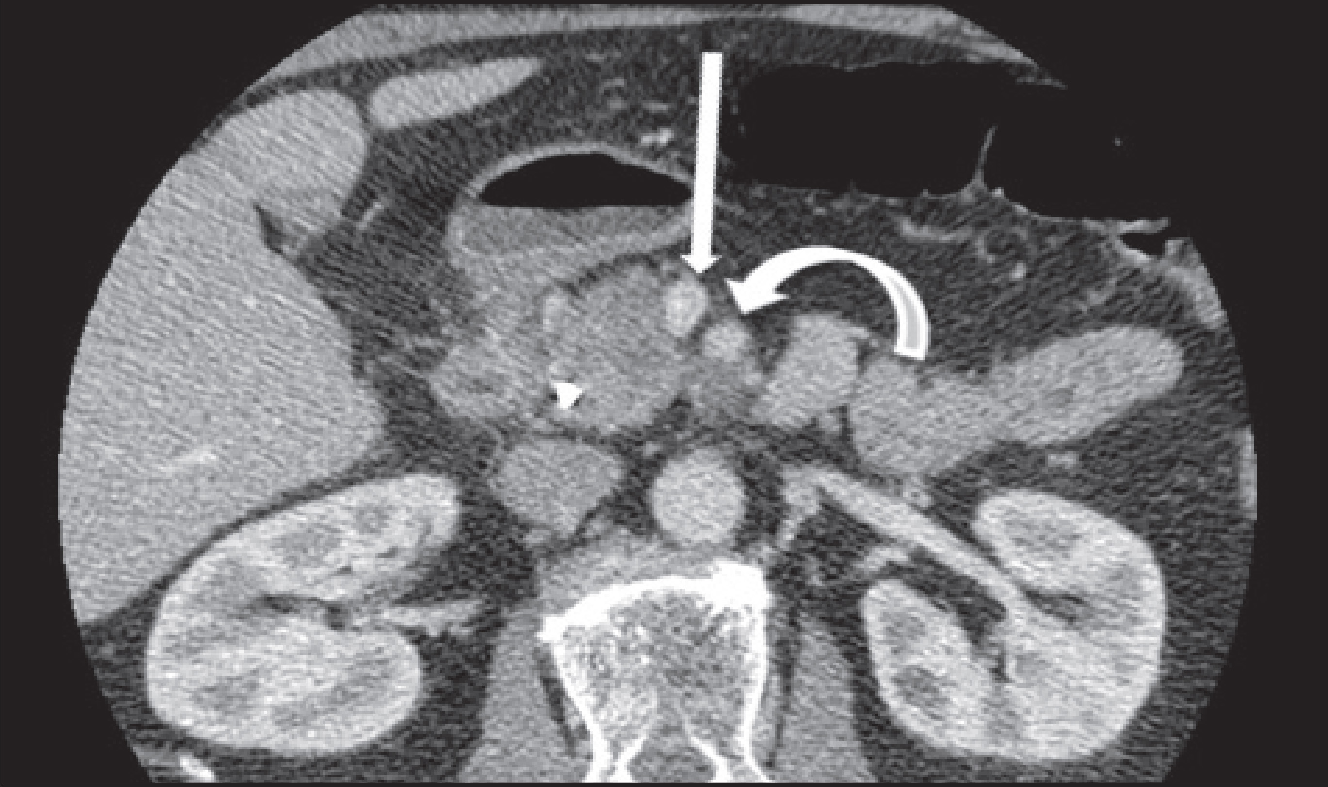 FIGURE 22.