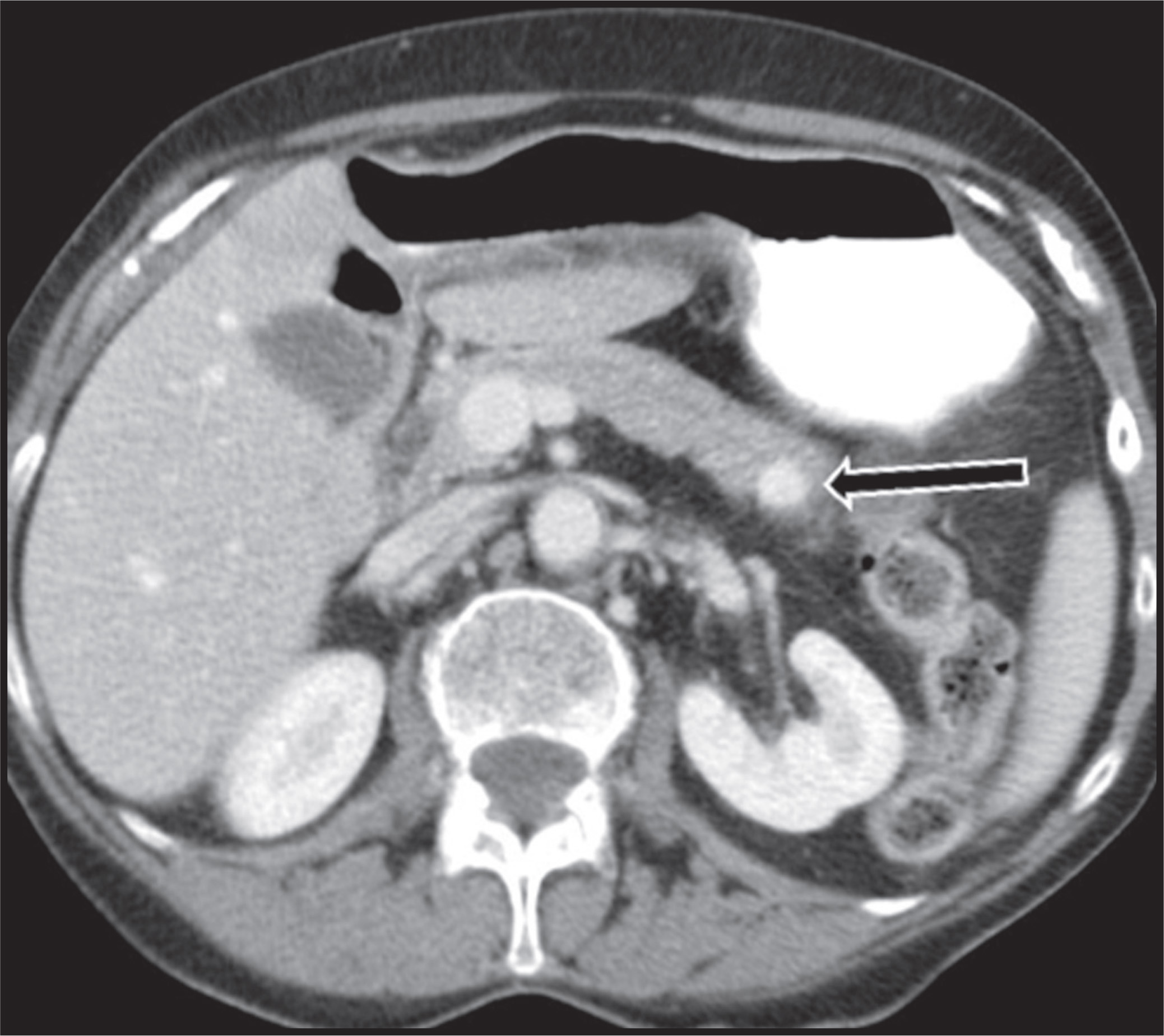 FIGURE 23.
