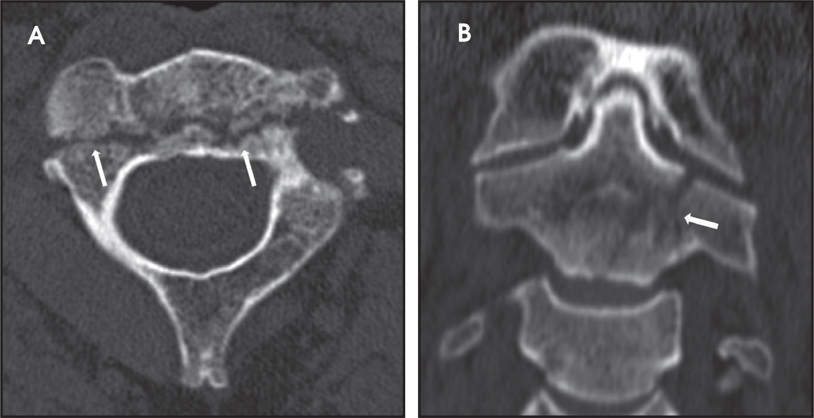FIGURE 11.