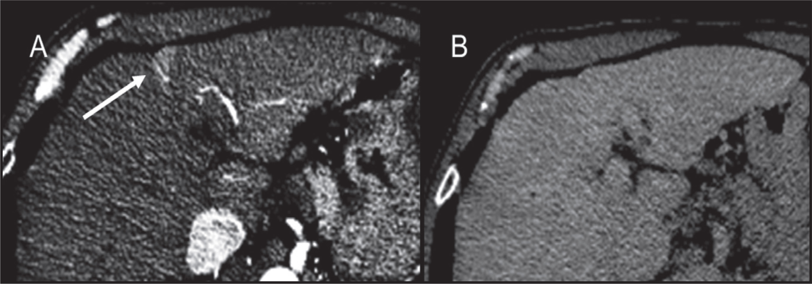 FIGURE 11.