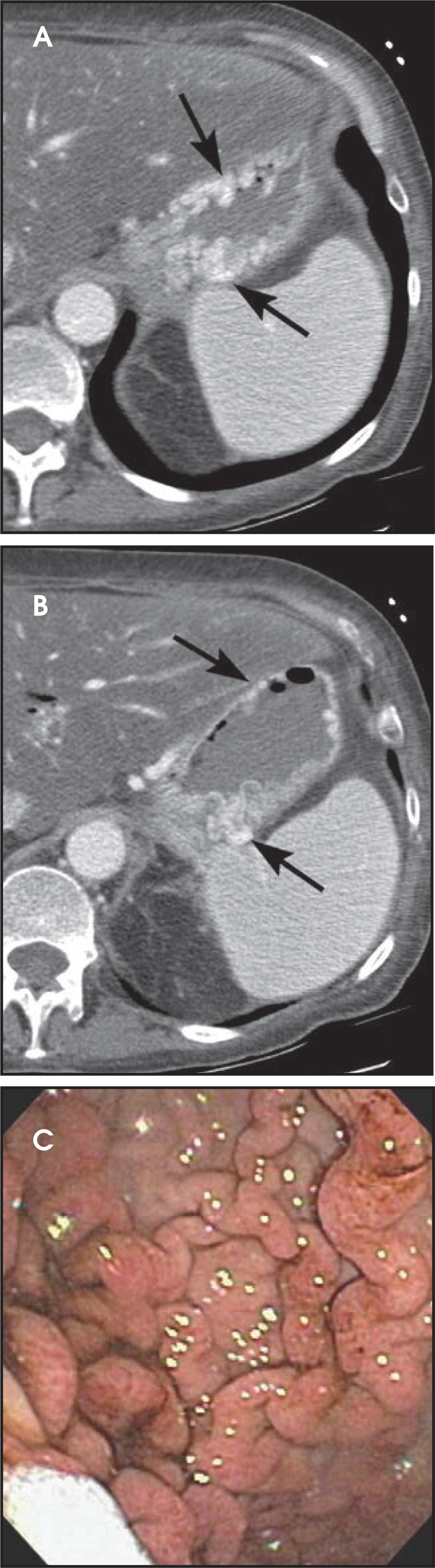 FIGURE 11.