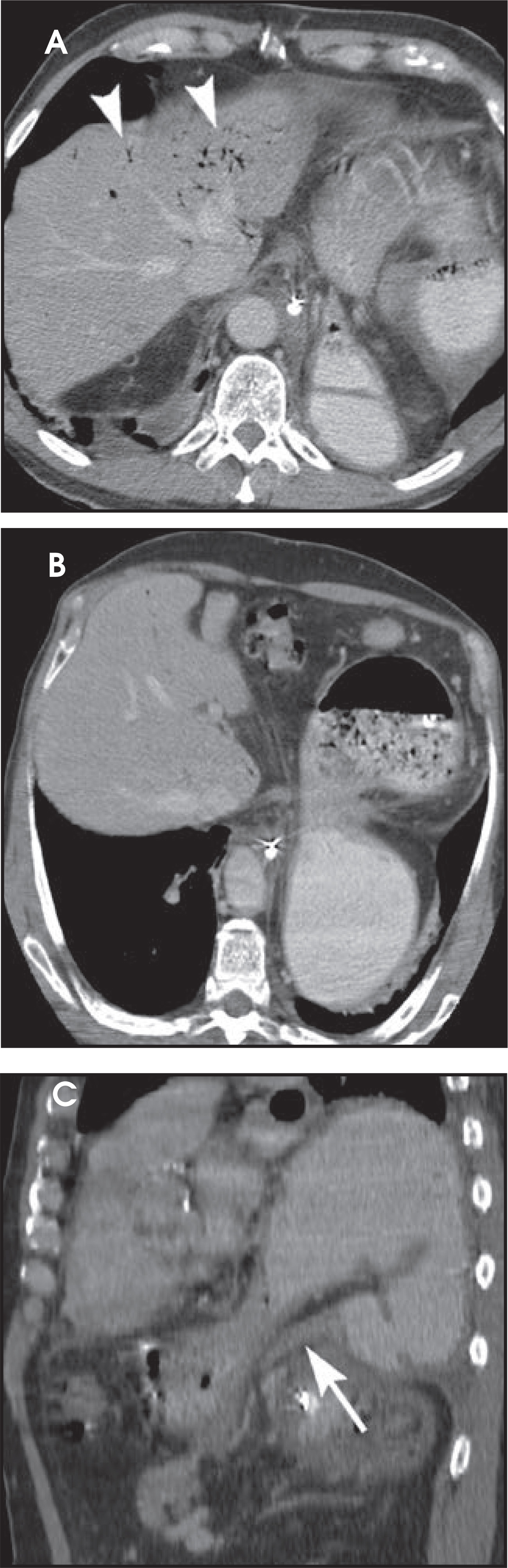 FIGURE 14.