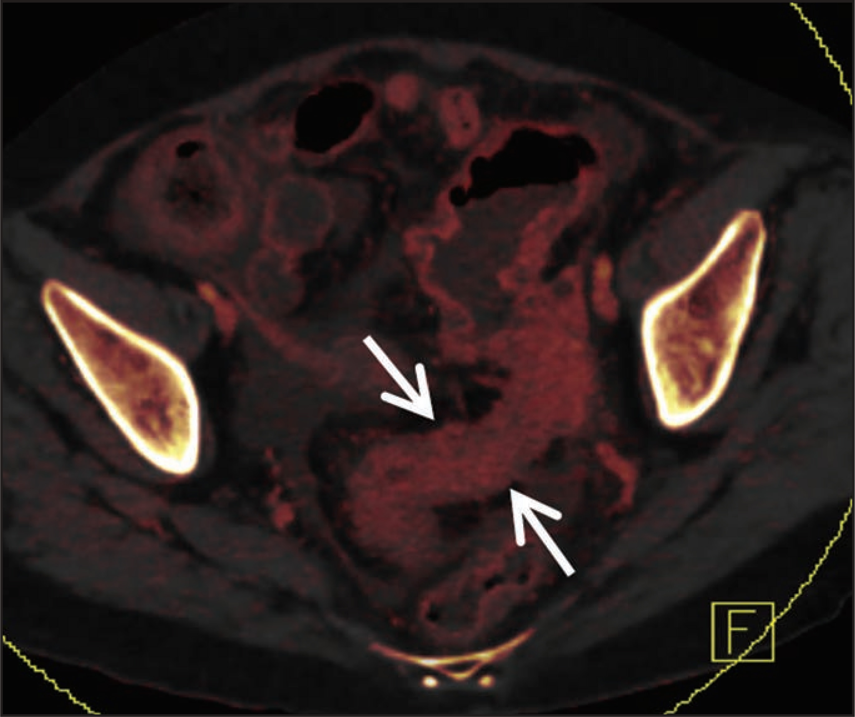 FIGURE 10.