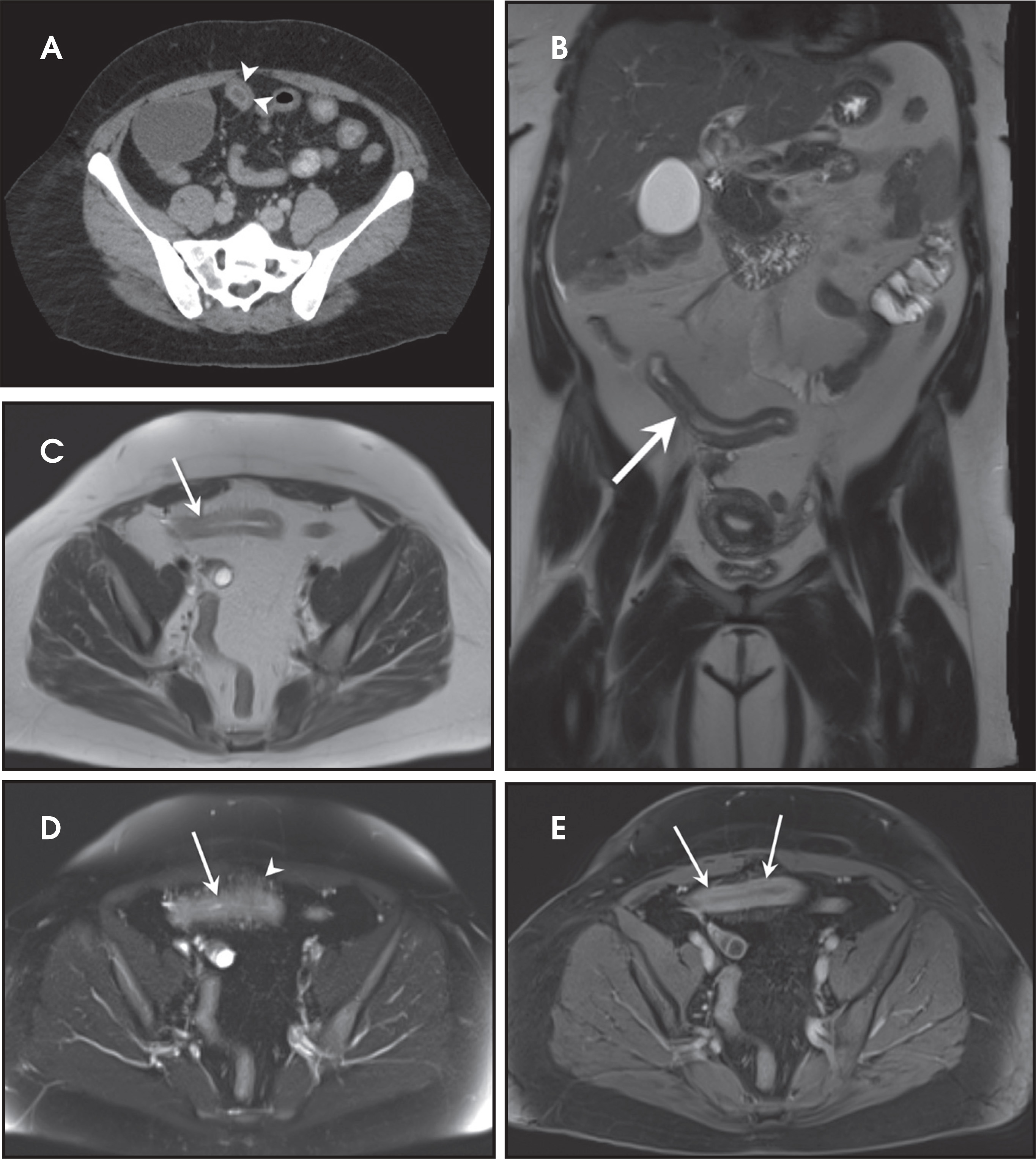 FIGURE 3.
