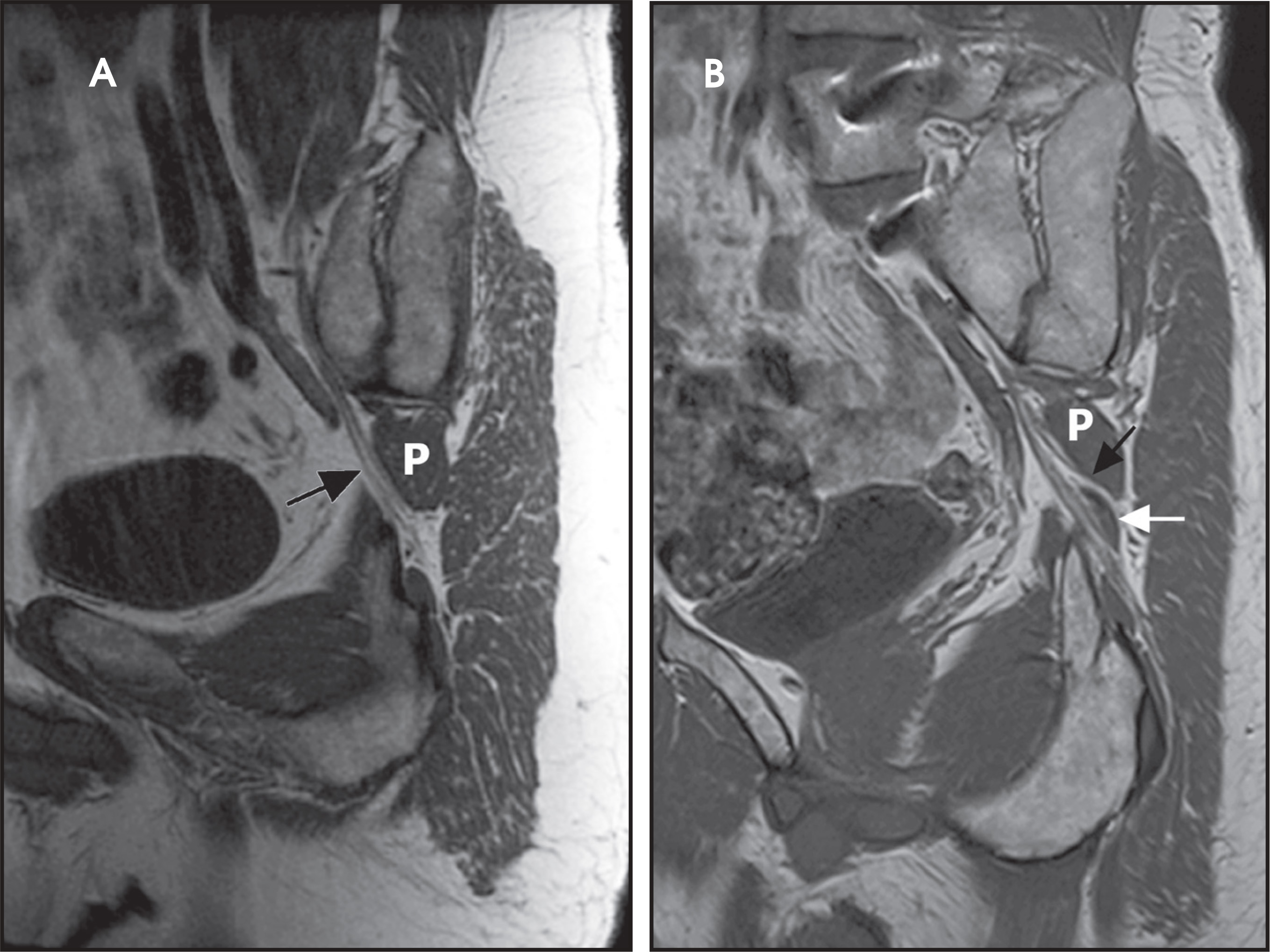 FIGURE 11.