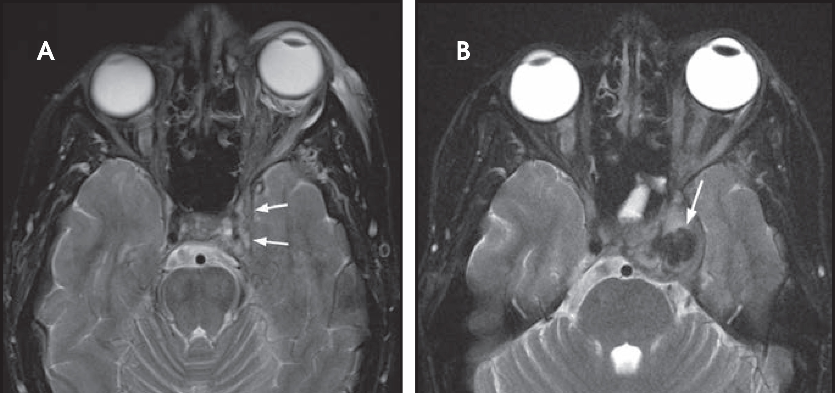 FIGURE 3.