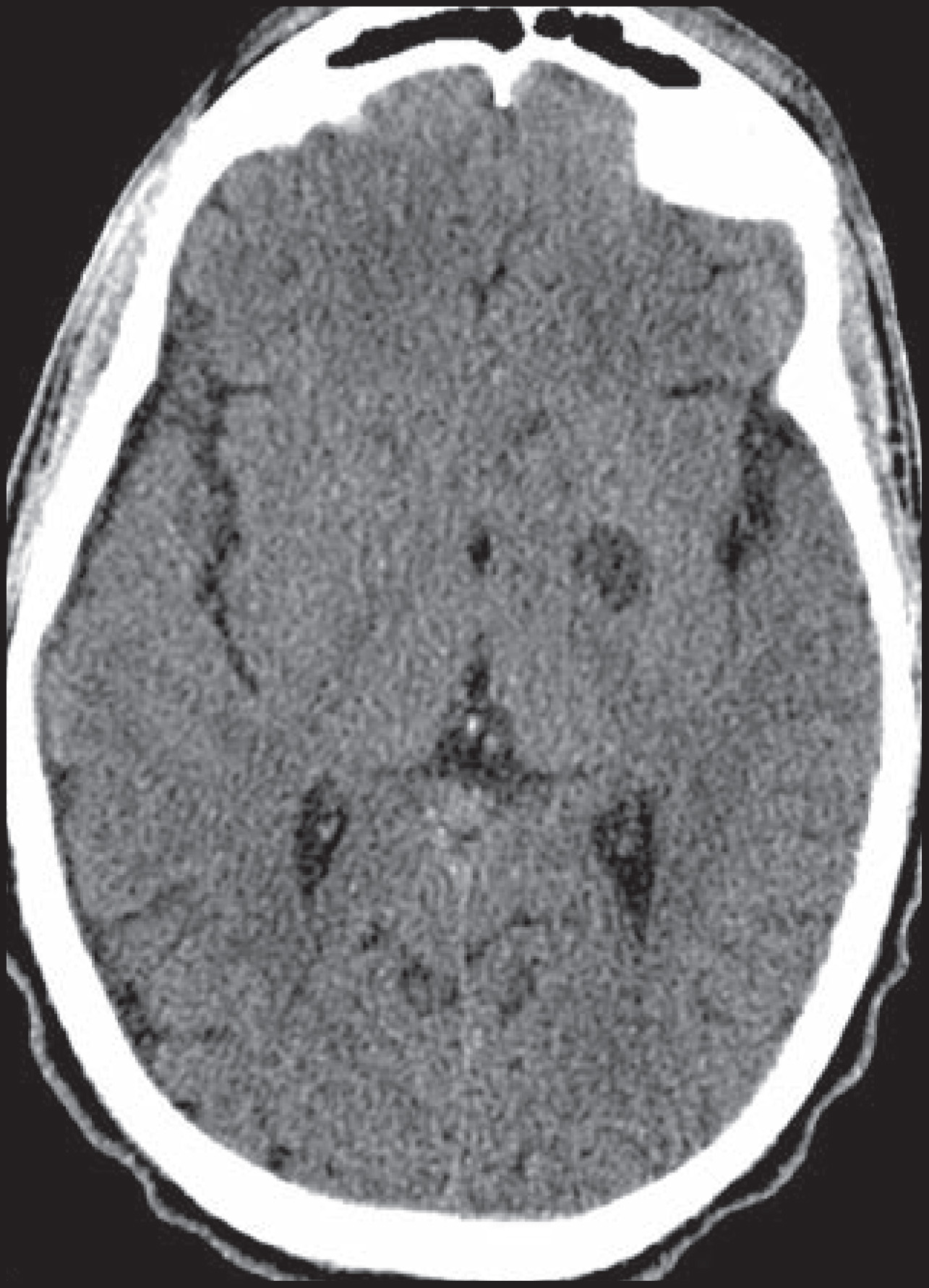 FIGURE 11.