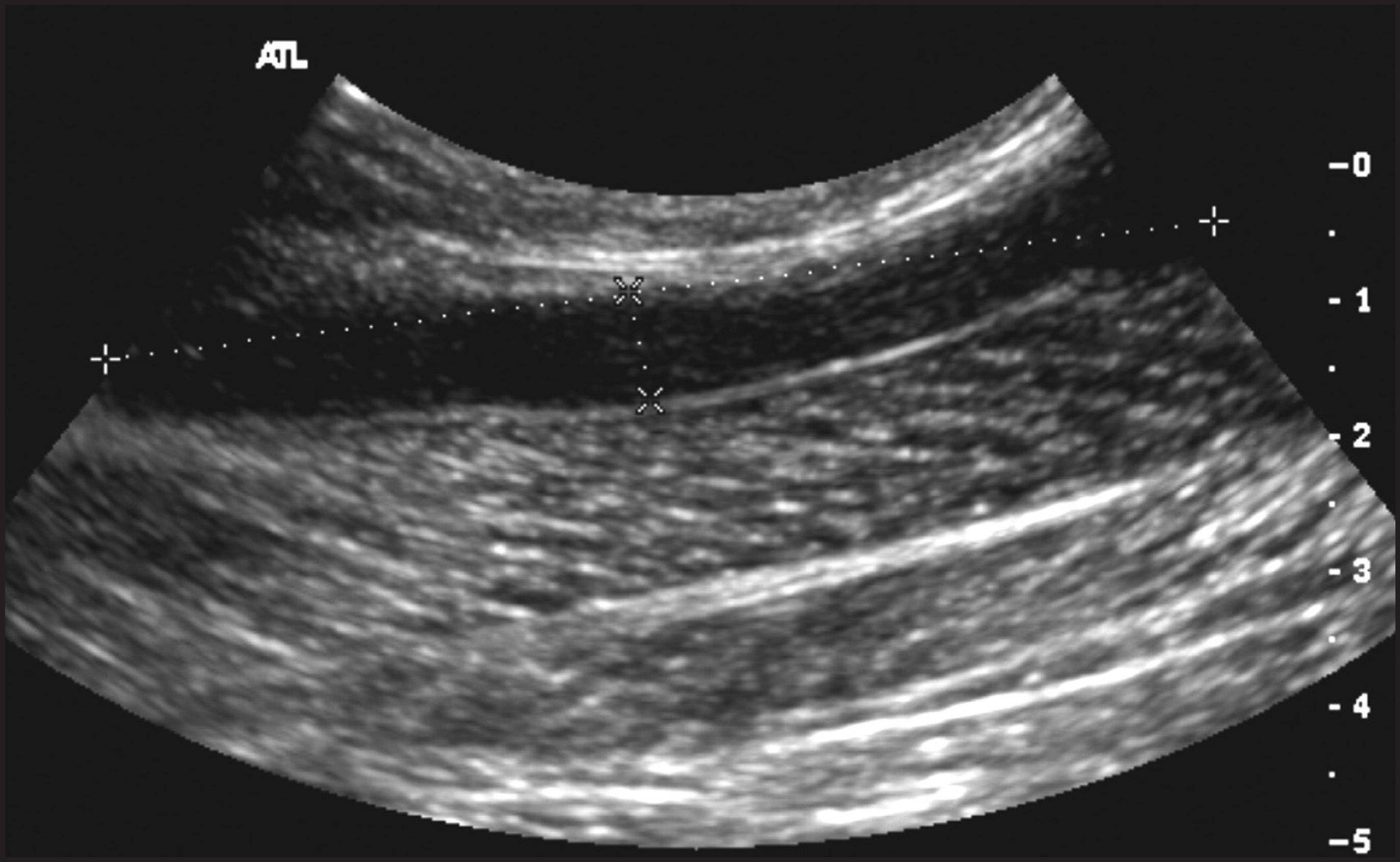 FIGURE 4.