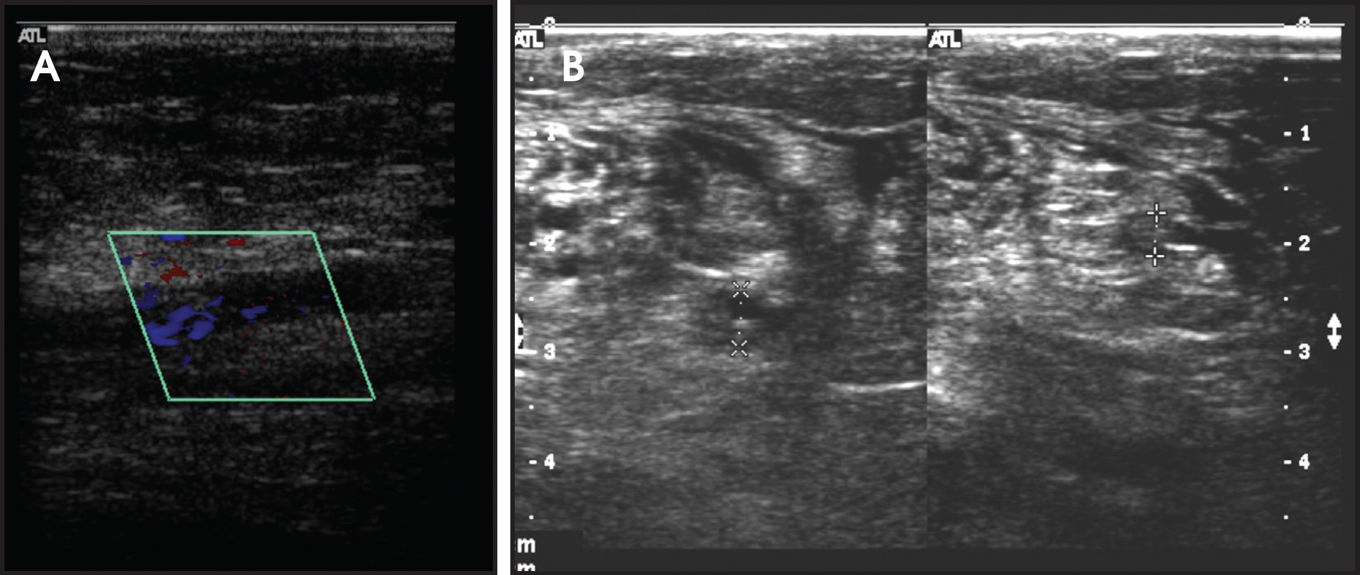 FIGURE 9.