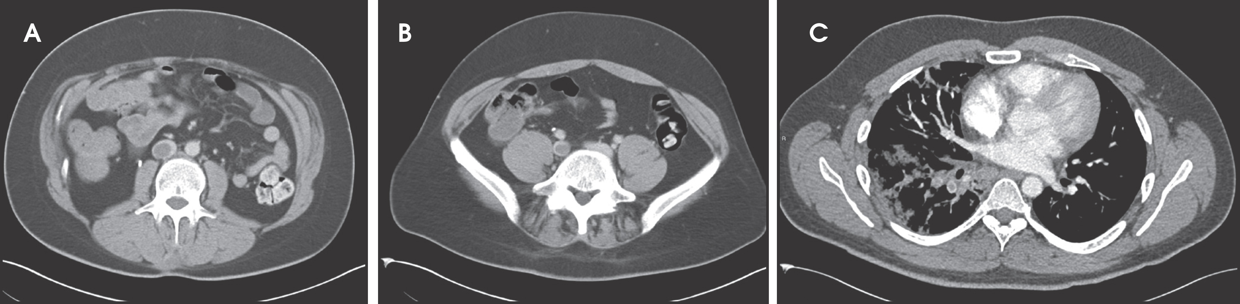 FIGURE 11.