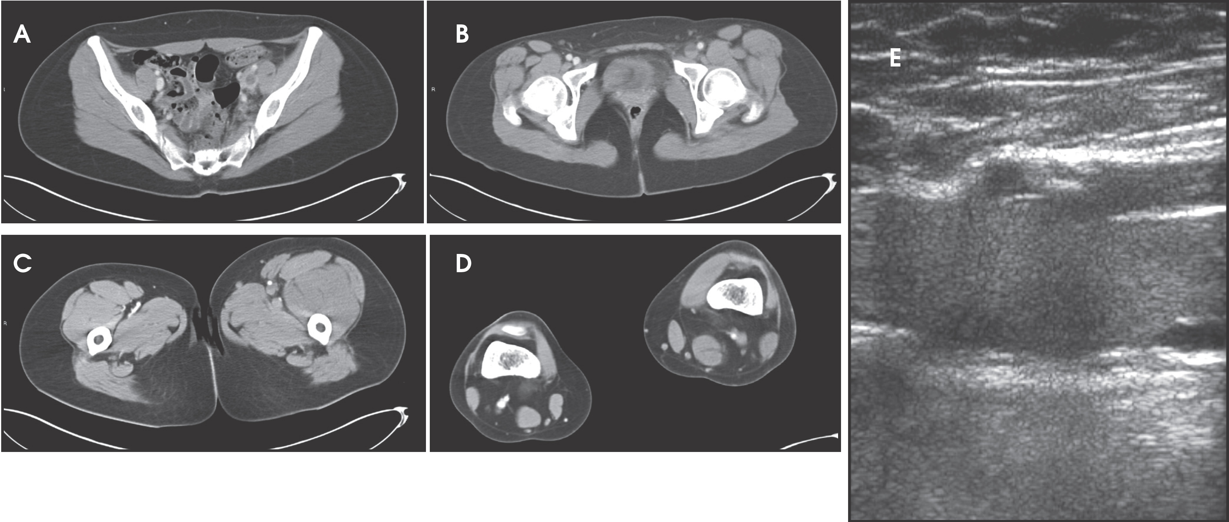 FIGURE 13.