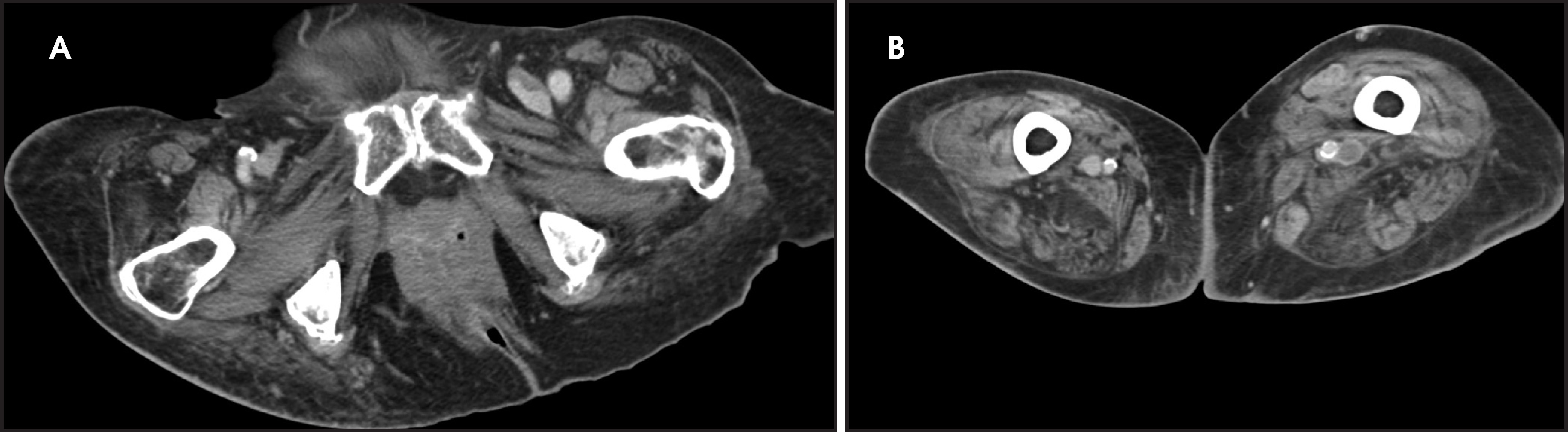 FIGURE 14.