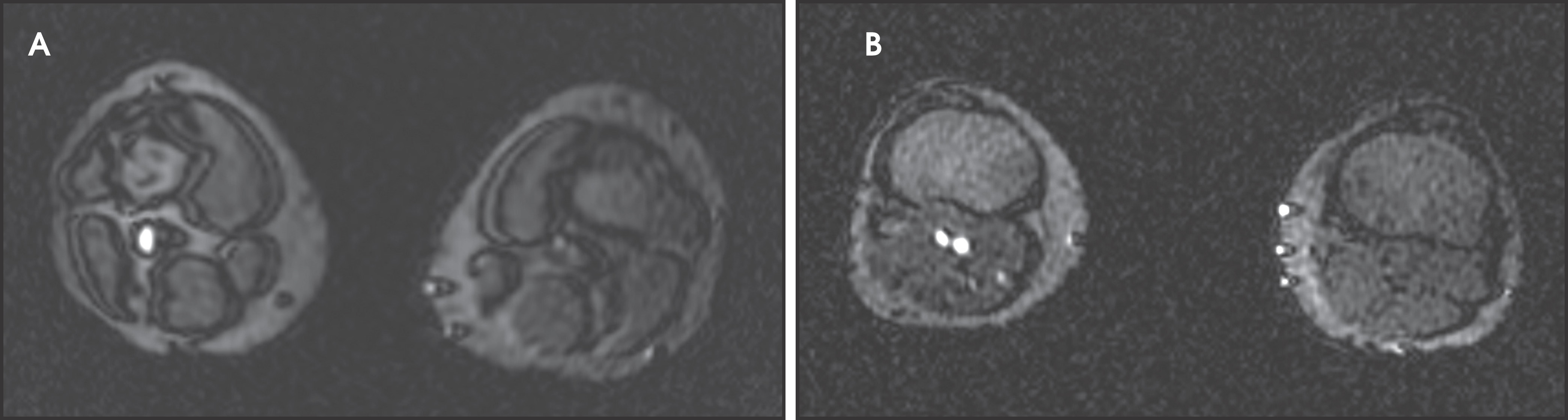 FIGURE 17.