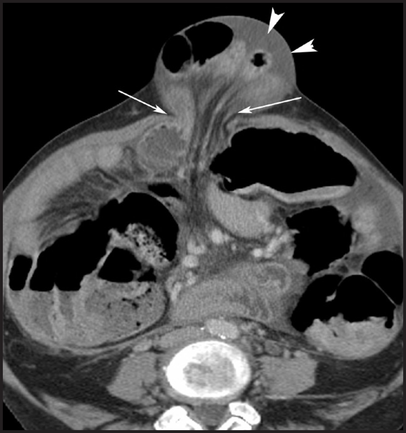 FIGURE 4.