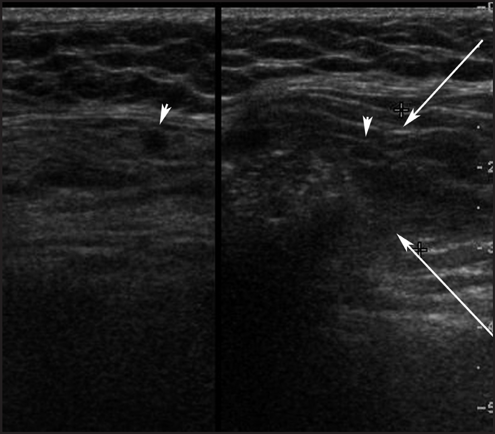 FIGURE 9.