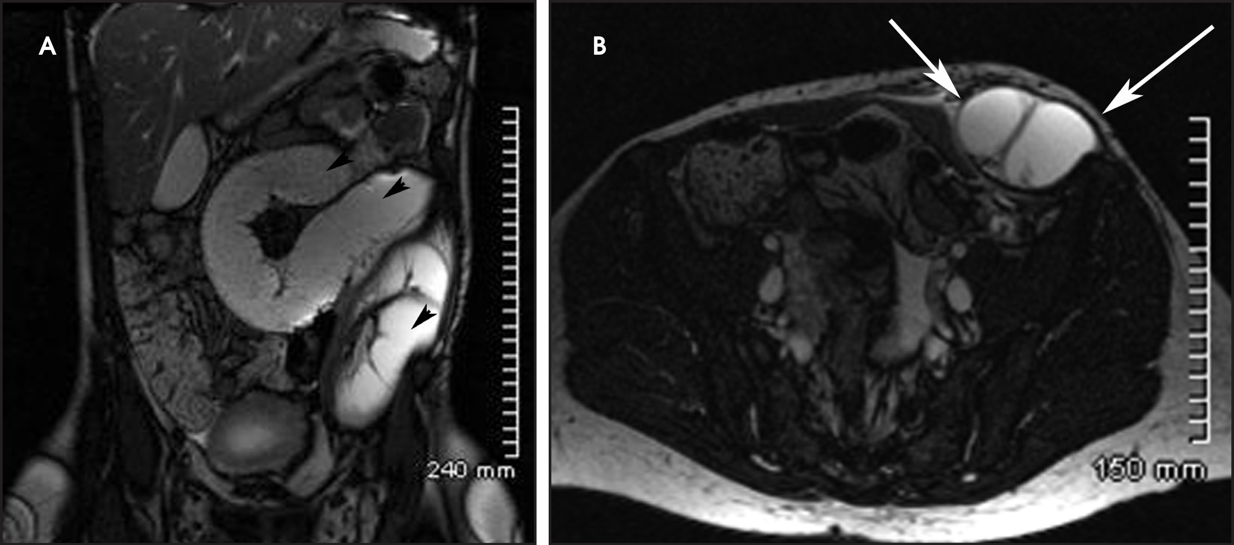 FIGURE 11.