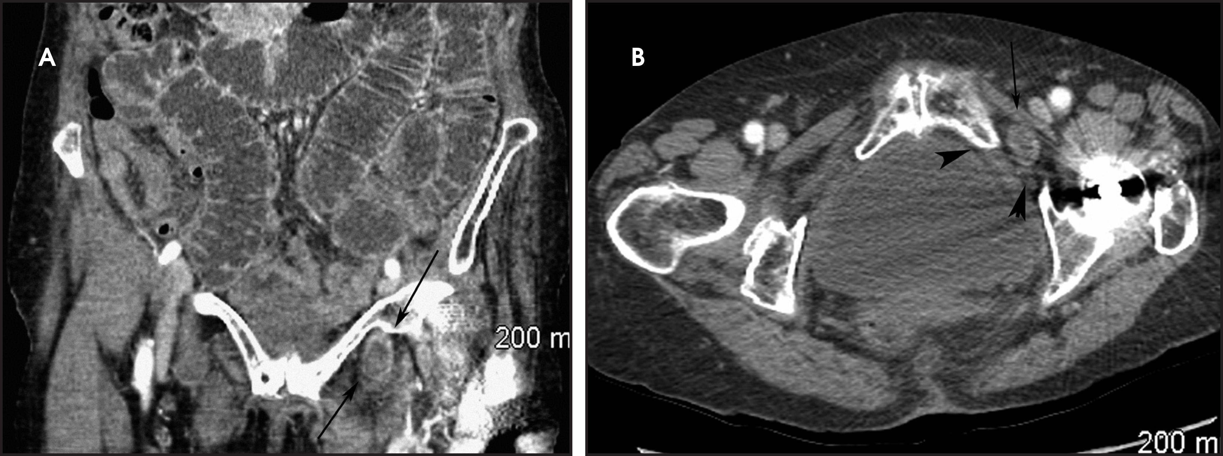 FIGURE 12.