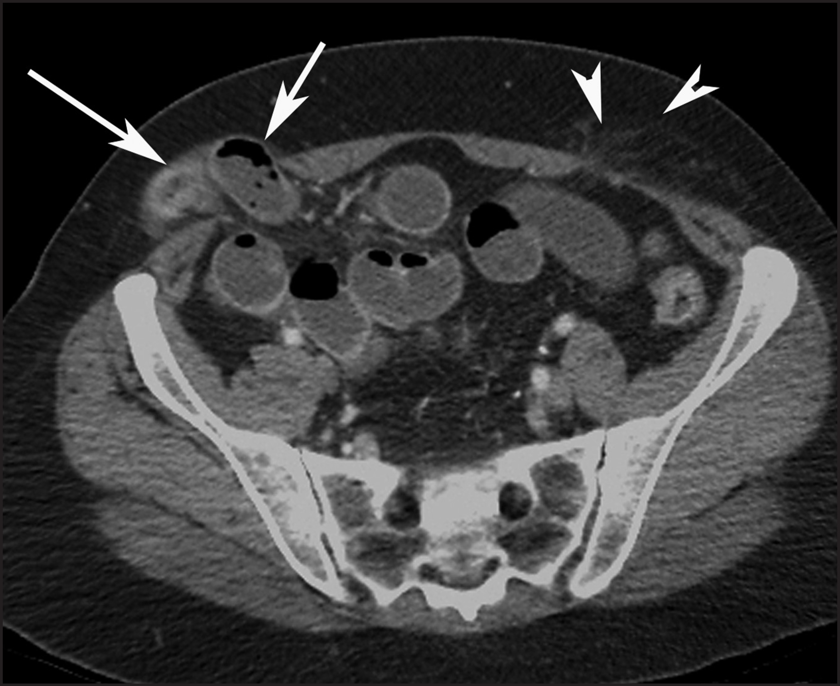FIGURE 13.
