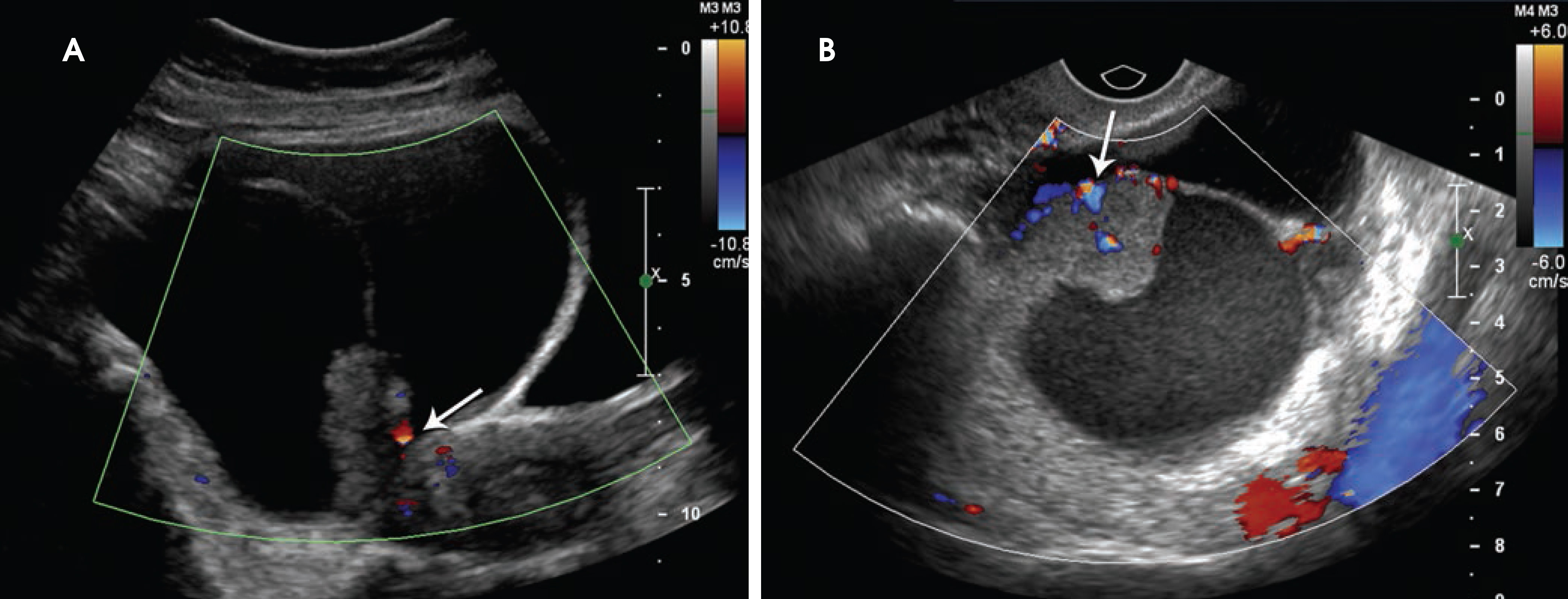 FIGURE 11.