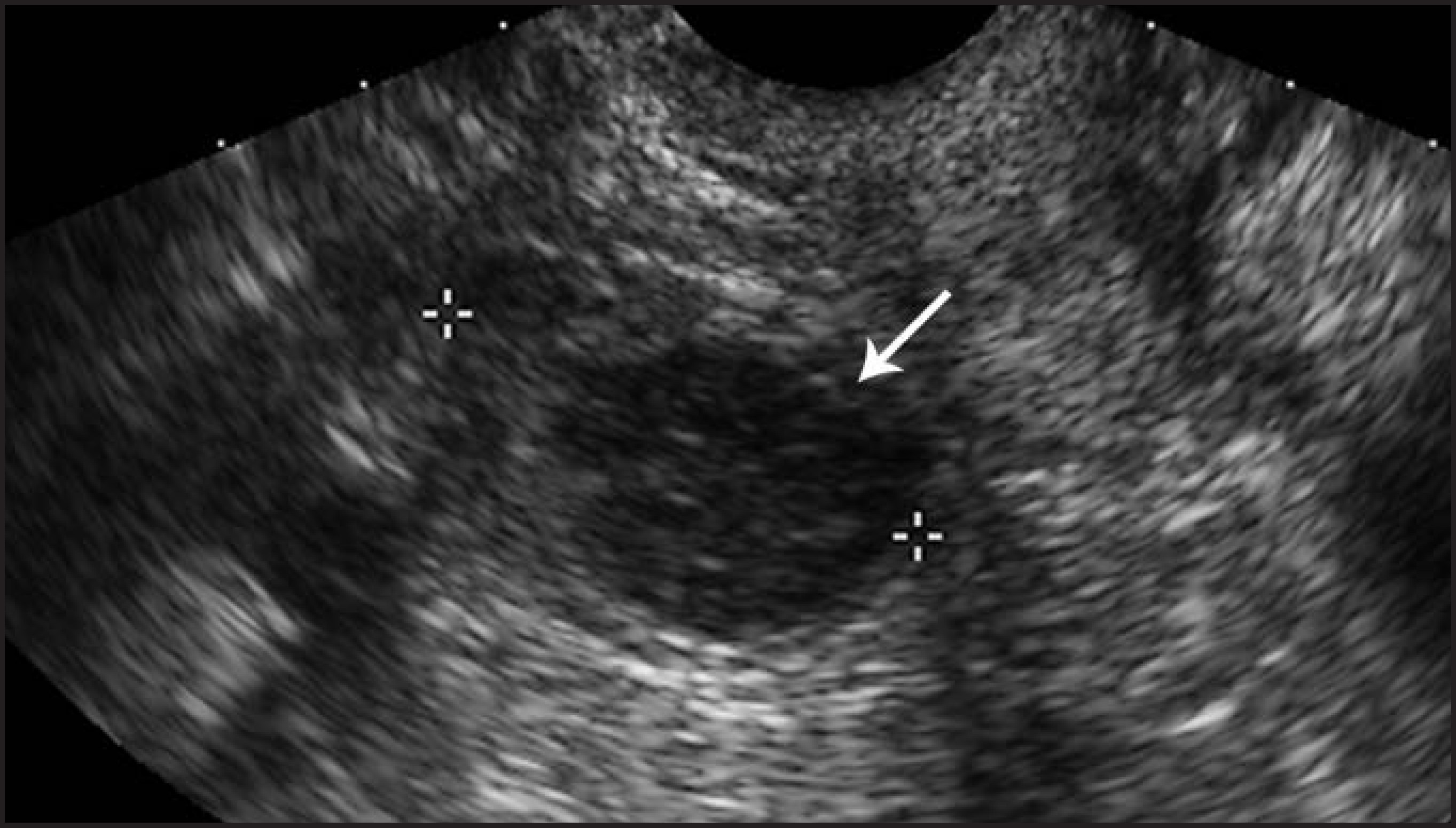 FIGURE 14.