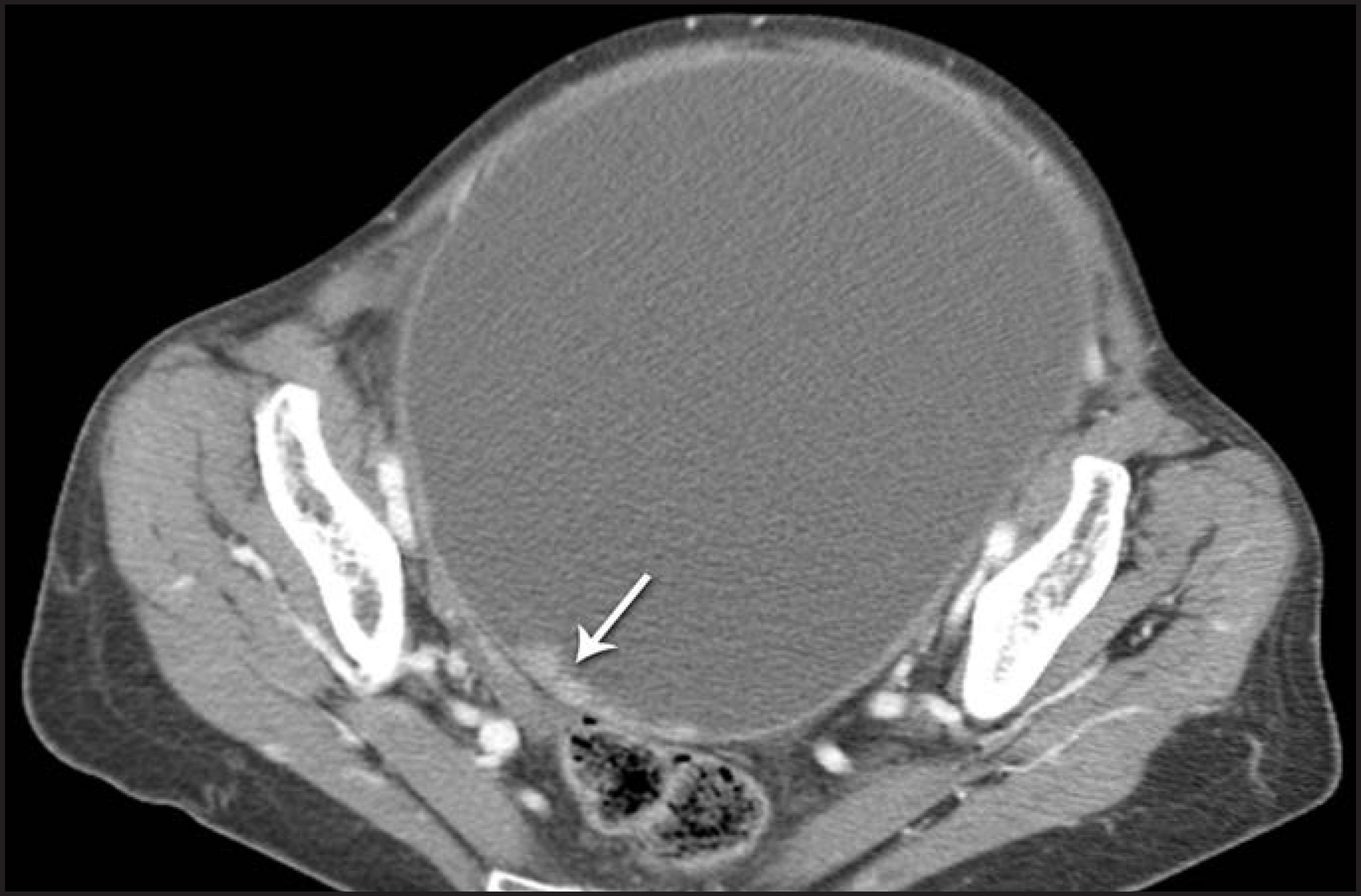 FIGURE 17.