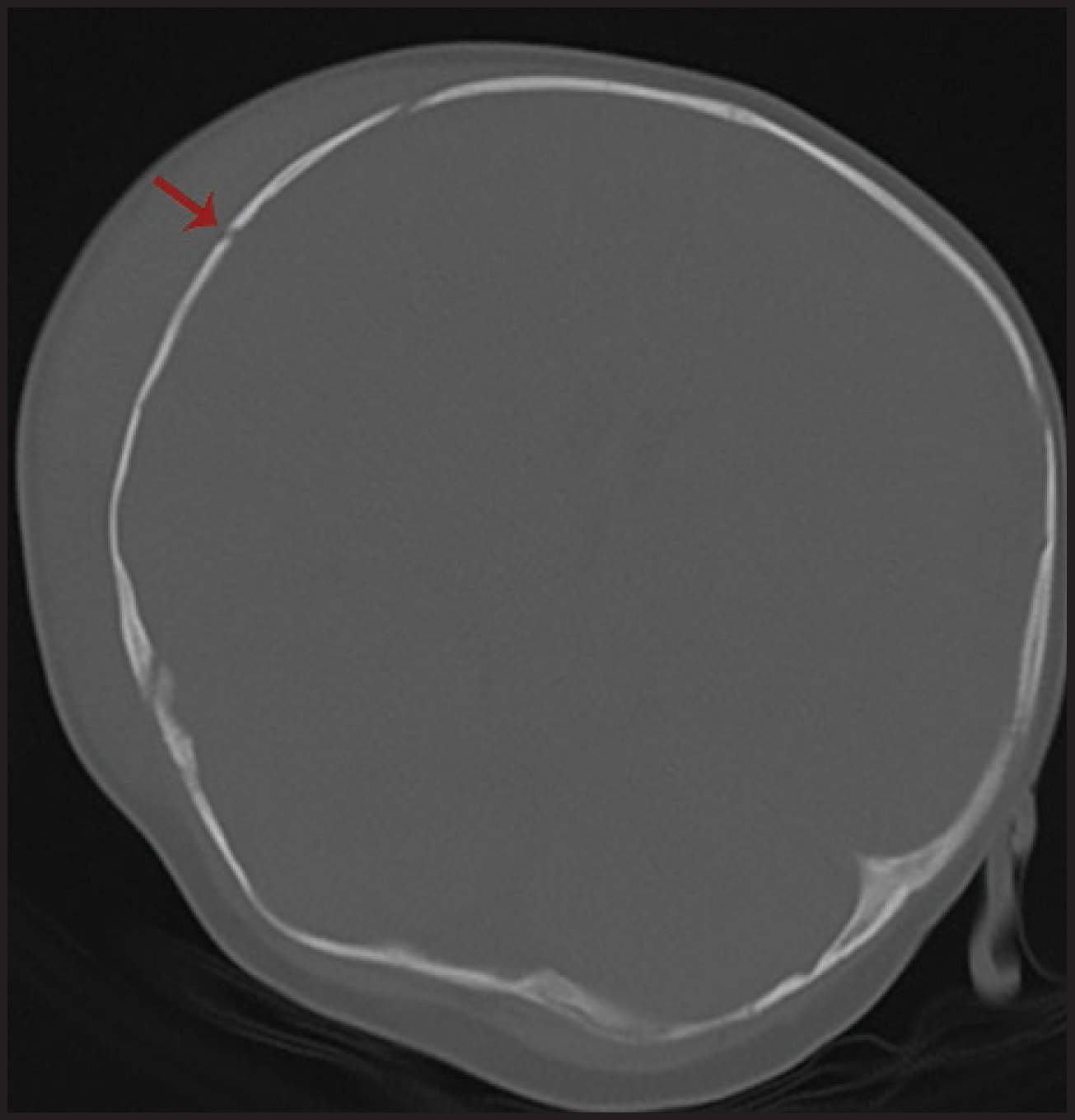 FIGURE 2.