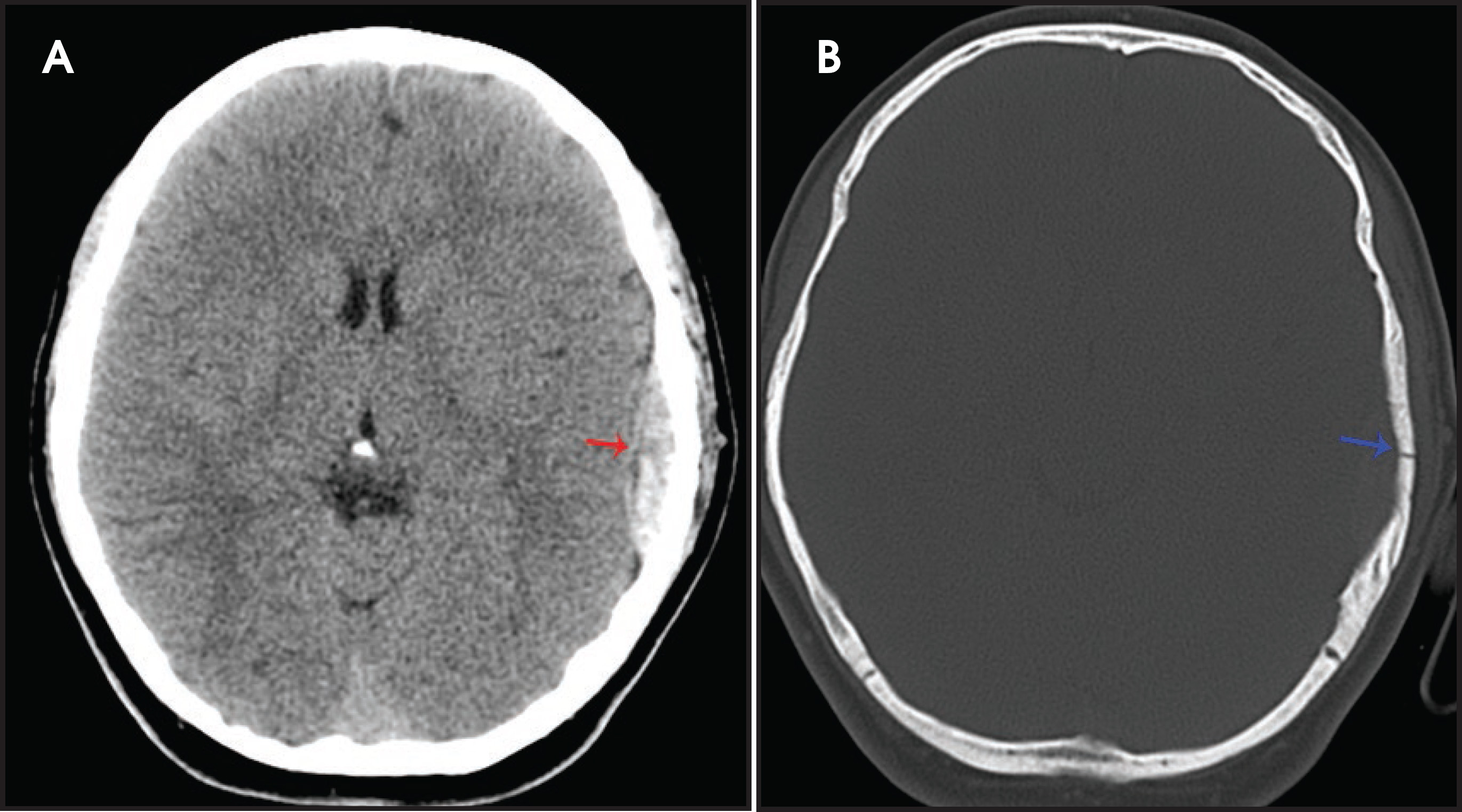 FIGURE 4.