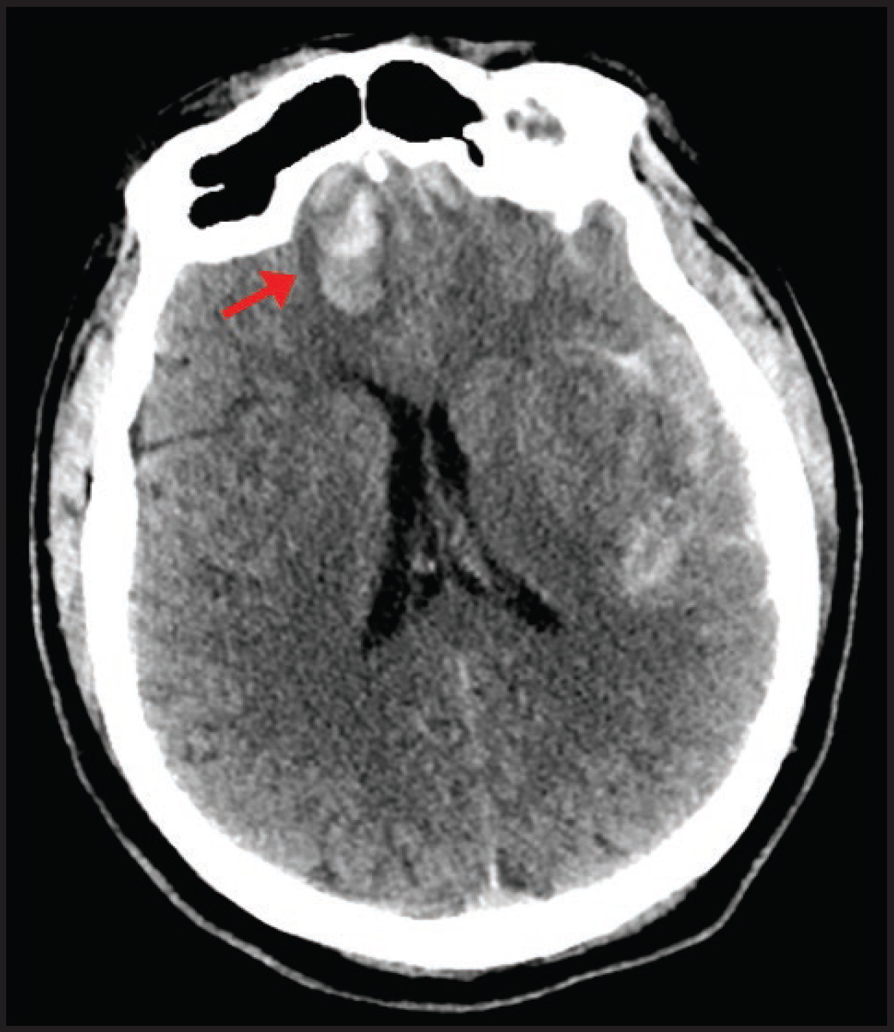 FIGURE 9.