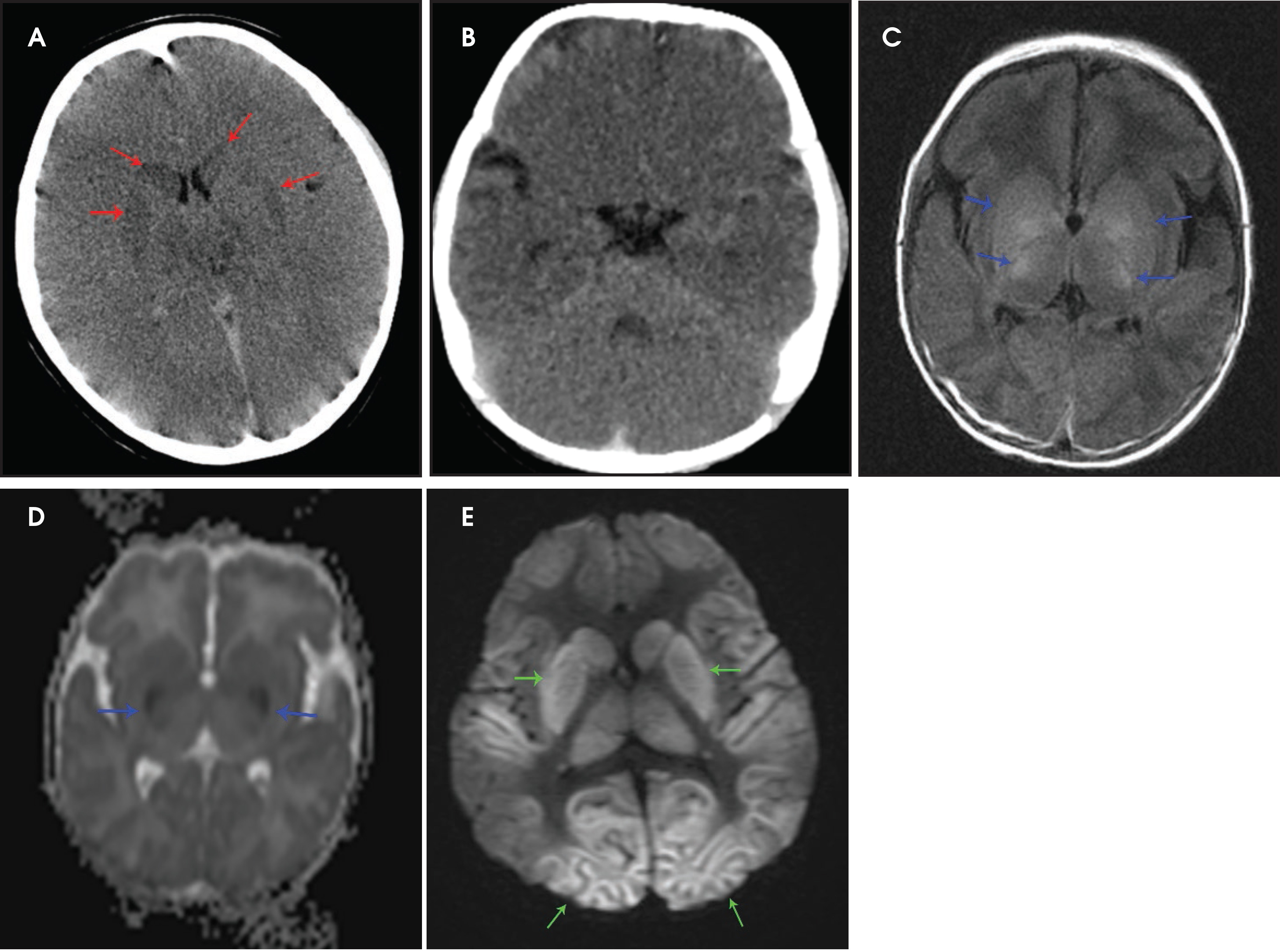 FIGURE 11.