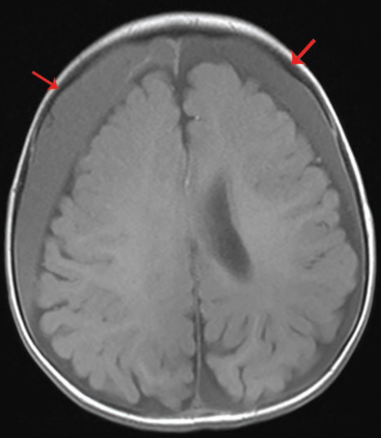 FIGURE 13.