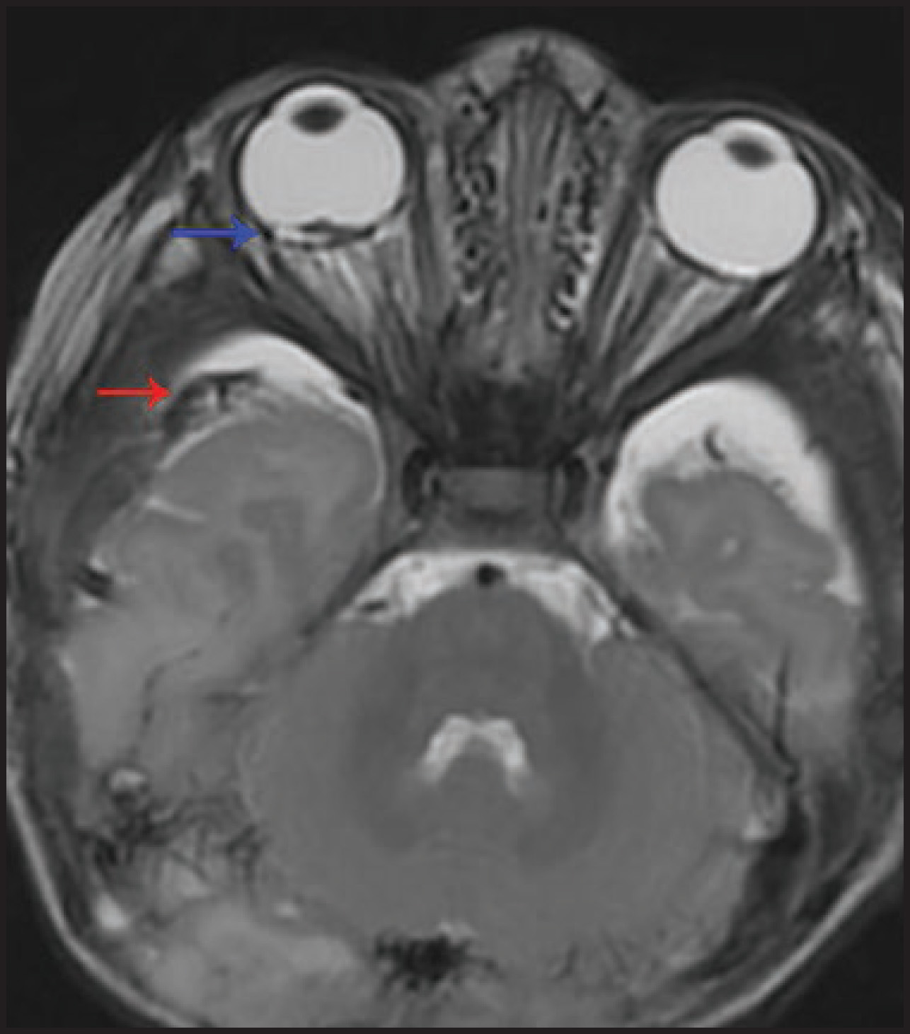FIGURE 14.
