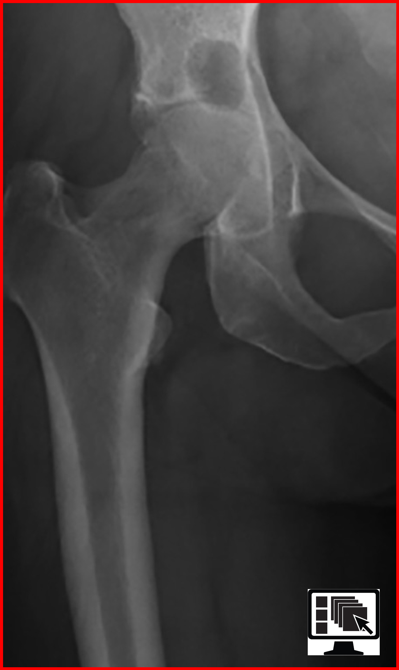 FIGURE 4.